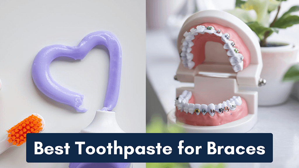 best toothpaste for braces